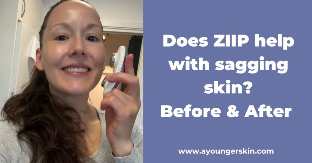 You are currently viewing Does ZIIP help with sagging skin? – Before & After