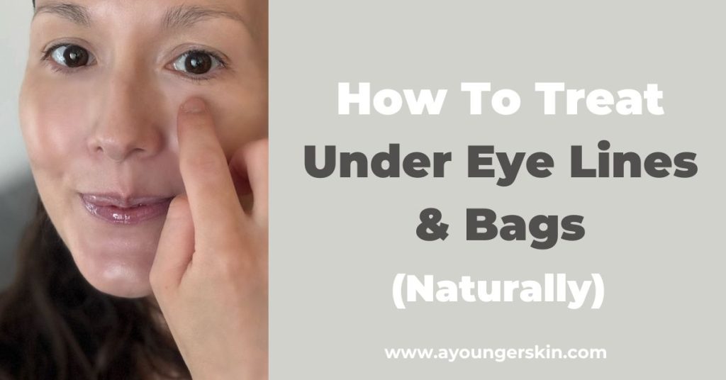 You are currently viewing How to treat under eye lines and eye bags [naturally]