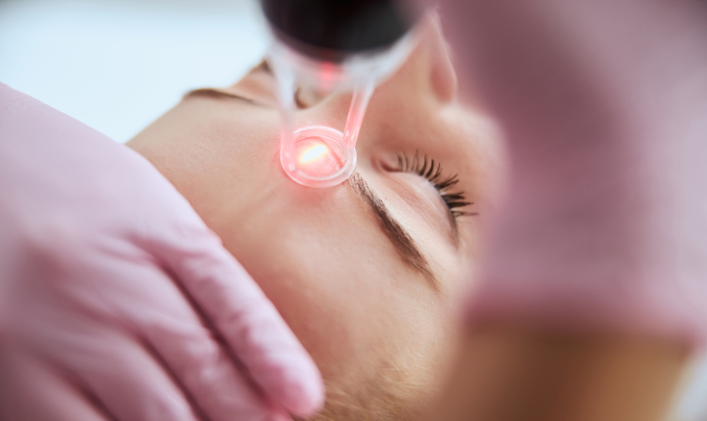 CO₂ laser skin resurfacing treatment at About Face Aesthetics in Philadelphia